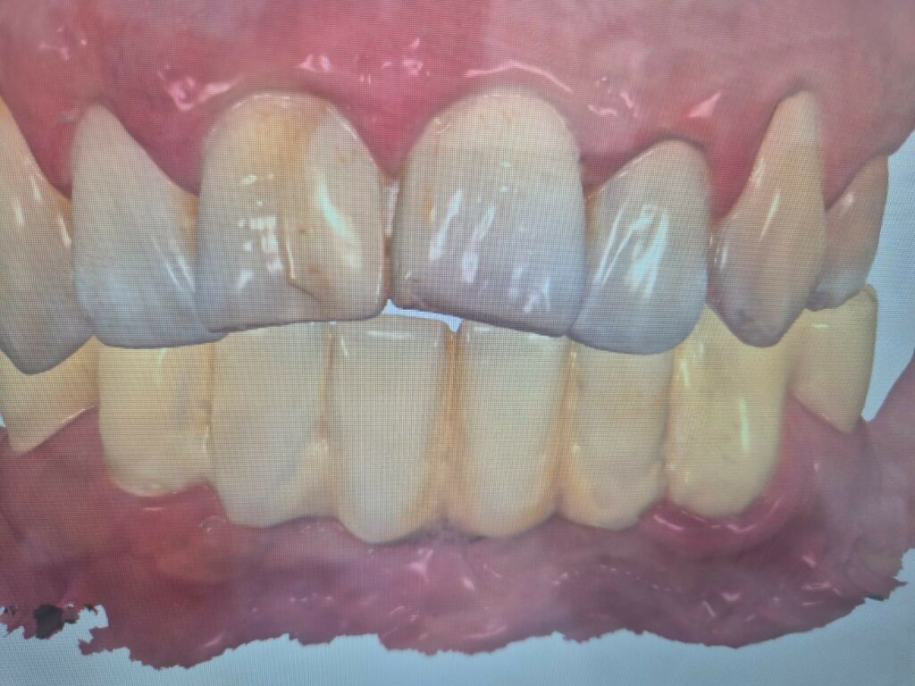 przed leczeniem