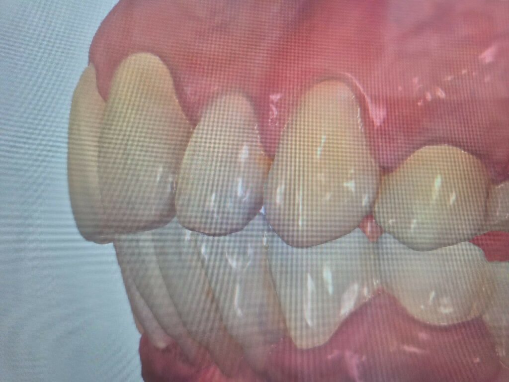 Przed leczeniem